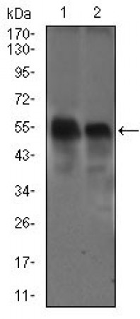 DCTN4 Primary Antibody  MP30469P [M3G9D7]