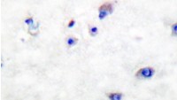 Anti-BACE1 / BACE Antibody (Asp492) MX-C176262