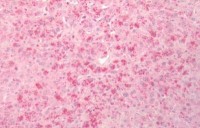 Anti-BACE1 / BACE Antibody (N-Terminus) IHC-plus™ MX-A8548