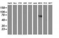 Anti-BCHE / Cholinesterase Antibody (clone 1E1) MX-C172585