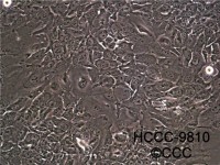 MCF0033  人胆管细胞型肝癌细胞；HCCC-9810