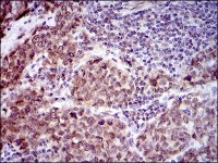CLGN Primary Antibody  MP30473P [M9C8G10]