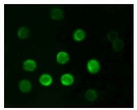 CD20 Primary Antibody MP20163 [M3E9D3C1G3]