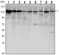 CDH1 Primary Antibody MP30121 [M7H12]