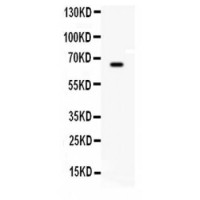 Anti-BCHE / Cholinesterase Antibody (aa263-571) MX-C407739