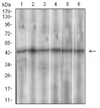 SSTR3 Primary Antibody MP30620 [M7H8E5]