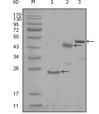 KARS Primary Antibody MP20238 [M8G12C1]