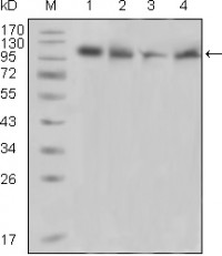 PYK2 Primary Antibody MP20212 [M5E2D5]