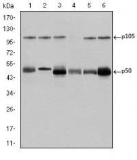 NFKB1 Primary Antibody MP30224 [M5D10]