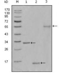 Ki67 Primary Antibody MP20305 [M9C12B2]