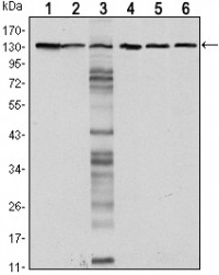 CDH1 Primary Antibody MP30127 [M7A2]