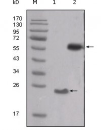 SRC Primary Antibody MP20218 [M5D10C4]