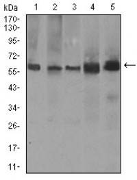 PDE1B Primary Antibody MP30465A  [M10B10B12]