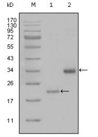 LPA Primary Antibody MP20294 [M8F6A9]