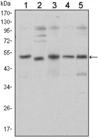 SMAD5 Primary Antibody MP30150  [M3H9]