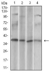 CD68 Primary Antibody MP30621 [M3F7D3]