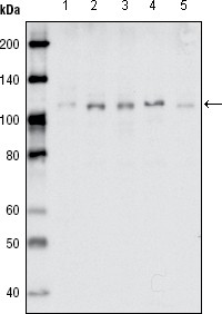EhpB1 Primary Antibody MP20184 [M5F10A4]