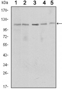 SIRT1 Primary Antibody MP30086 [M1F3]