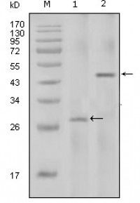 IL-2 Primary Antibody MP20316 [M8D5]