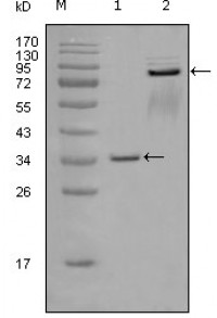 EphA7 Primary Antibody MP20275 [M6C8G7]