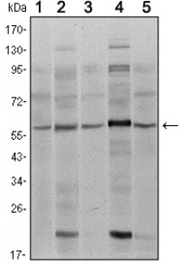 SMAD4 Primary Antibody MP30091 [M4G1C6]