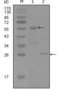PGR Primary Antibody MP20268 [M8A11H1]