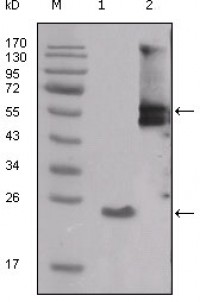 SRC Primary Antibody MP20200 [M4F1E8]