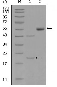 EphA5 Primary Antibody MP20292 [M8B10B1]