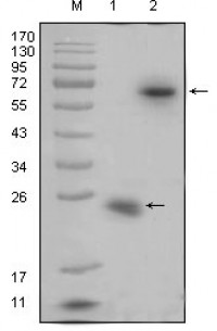 R-spondin1 Primary Antibody MP20317 [M7A6]
