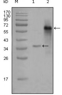 NCOA3 Primary Antibody MP20274 [M2C11B12]