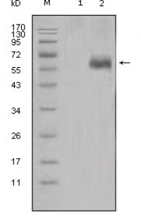 DKK1 Primary Antibody MP20325 [M2H2]