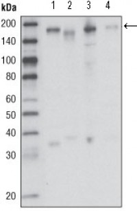 RON Primary Antibody MP20258 [M1B5A9]