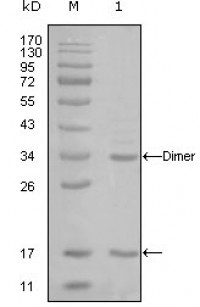 EP300 Primary Antibody MP20261 [M7D8A6]