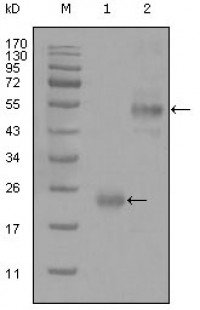 CD44 Primary Antibody MP20282 [M8E2F3]