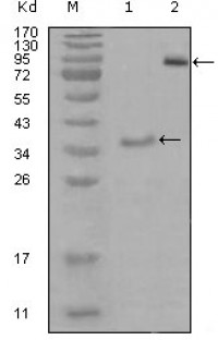 EphA3 Primary Antibody MP20252 [M6C1B6]