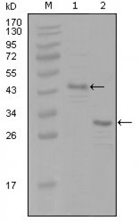 ESR1 Primary Antibody MP20272 [M8H9A10]