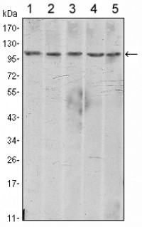 CDH2 Primary Antibody MP30042 [M5D5]