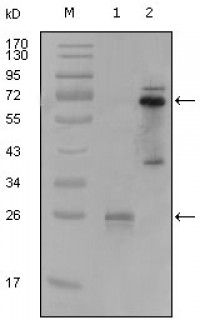 SYK Primary Antibody MP20211 [M8C1A3]