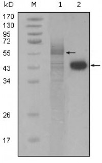 PAR4 Primary Antibody MP20213 [M3G9H7]