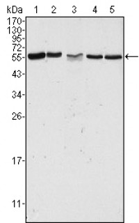 PAK2 Primary Antibody MP20356 [M3B5]
