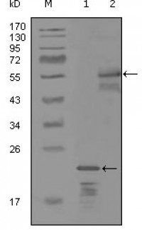 ERBB3 Primary Antibody MP20254 [M3F10F6]