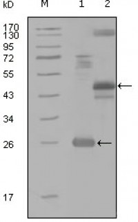 MAP4K4 Primary Antibody MP20234 [M4H9E7]