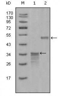 Mammaglobin-1 Primary Antibody MP20299 [M1G8D6]
