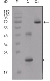 IGFBP2 Primary Antibody MP20204 [M1F6F6]