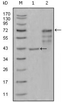 CHIT1 Primary Antibody MP20302 [M1D9G2]