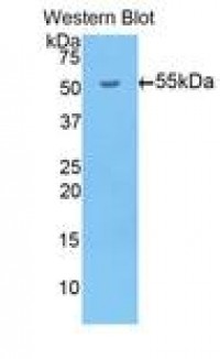 Anti-BACE1 / BACE Antibody (aa190-430, Biotin) MX-C297572