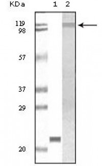 Tyk2 Primary Antibody MP20091 [M8G8B3]