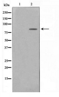 Anti-BTK Antibody (phospho-Tyr223) MX-C416342