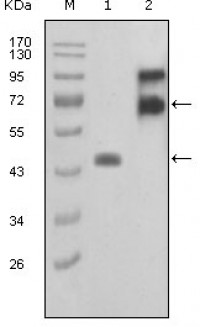 FBLN2 Primary Antibody MP20190 [M7H4F6]