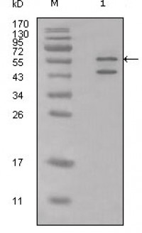 Calreticulin Primary Antibody MP20177 [MN/A]